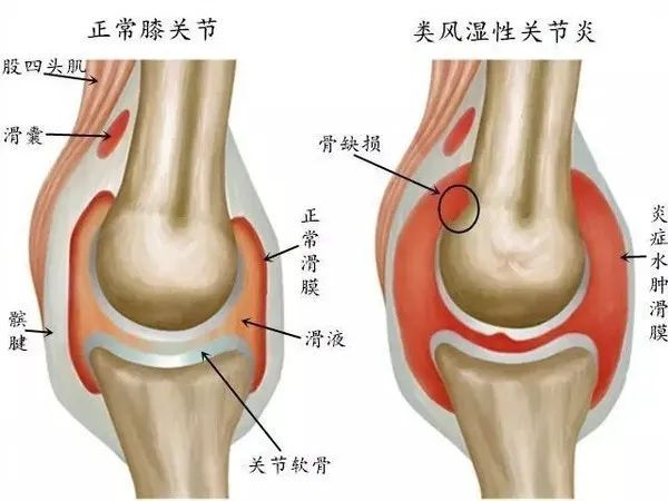 弘億康中醫定向透藥治療儀骨關節