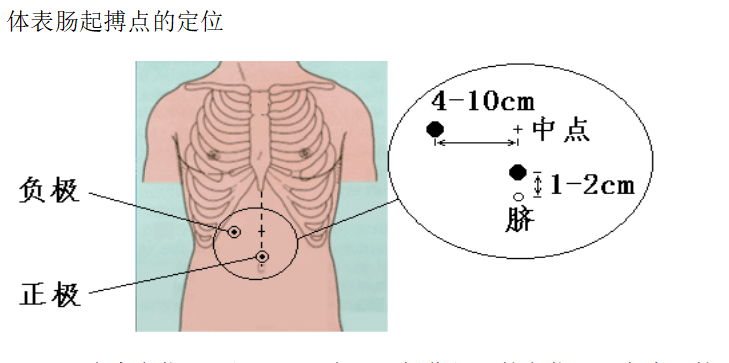 胃腸動力治療儀起搏點定位